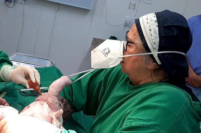 Vừa chào đời, bé sơ sinh đã kéo rơi cả khẩu trang bác sĩ - Ảnh 1.