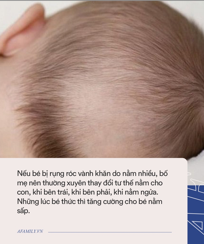 Bác sĩ nhi khoa giải đáp: Cắt tóc máu hay bôi dầu dừa có làm cho tóc của trẻ mọc dày và đẹp hơn không? - Ảnh 2.