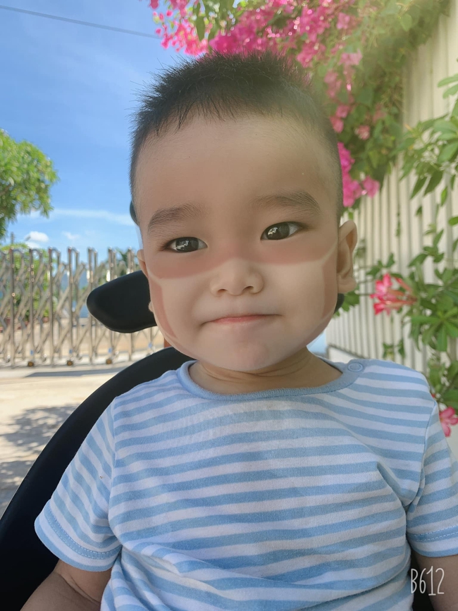 Xôn xao khắp Facebook: Xuất hiện nhiều em bé bị cháy nắng &quot;bá đạo&quot;, in hằn nguyên chiếc khẩu trang trên mặt, chuyện gì đang xảy ra? - Ảnh 7.