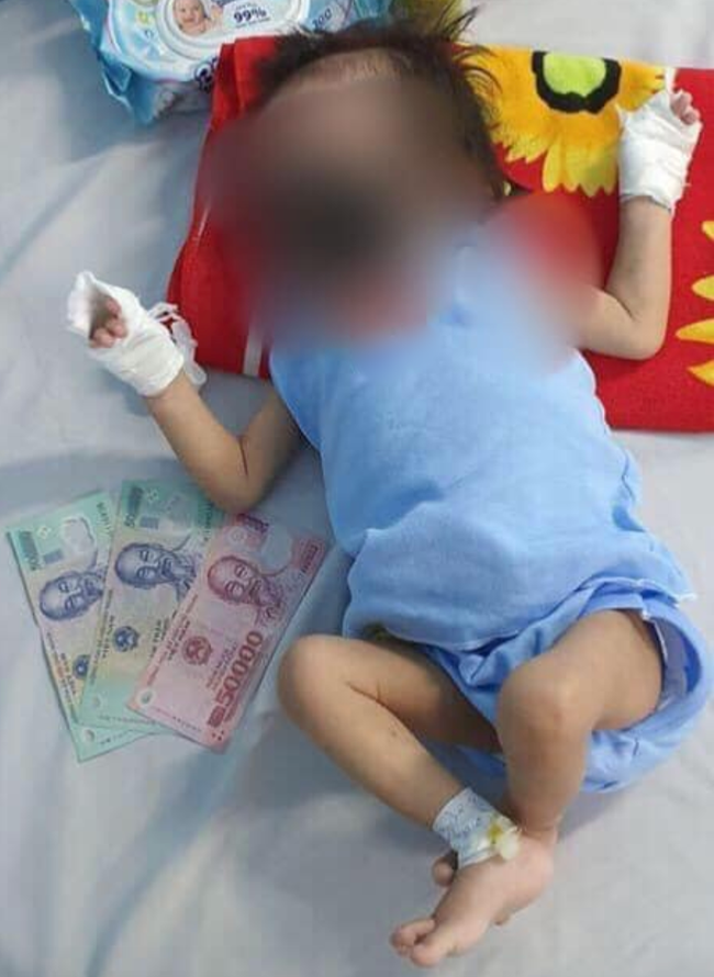 Kẻ gian nhẫn tâm lấy hình ảnh bé gái 15 tháng tuổi bỏng nặng đăng Facebook, bịa chuyện điều trị ở BV Chợ Rẫy để trục lợi - Ảnh 3.
