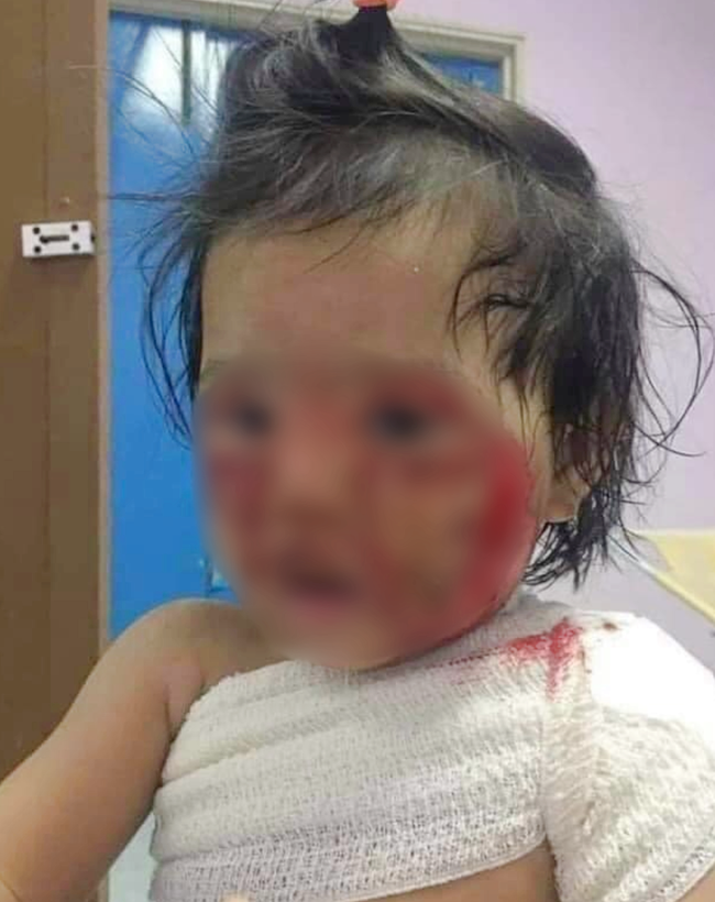 Kẻ gian nhẫn tâm lấy hình ảnh bé gái 15 tháng tuổi bỏng nặng đăng Facebook, bịa chuyện điều trị ở BV Chợ Rẫy để trục lợi - Ảnh 2.