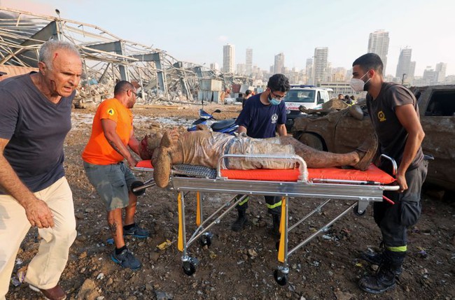 Hình ảnh gây sốc về nạn nhân kẹt dưới gầm xe nhuốm đầy máu sau vụ nổ Beirut và cái kết đầy bất ngờ - Ảnh 4.
