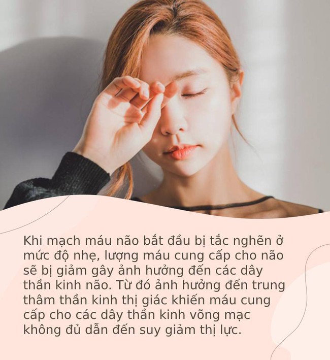 Nếu xuất hiện 4 biểu hiện này, nên đi khám và kiểm tra kịp thời vì rất có thể bạn đang mắc chứng nhồi máu não mà không hề biết - Ảnh 2.