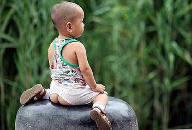 Bé gái 1 tuổi mắc bệnh lây truyền qua đường tình dục, thủ phạm là cách mặc quần mà nhiều cha mẹ mắc - Ảnh 1. Bé gái 1 tuổi mắc bệnh lây truyền qua đường tình dục, thủ phạm là cách mặc quần mà nhiều cha mẹ mắc - Ảnh 1.
