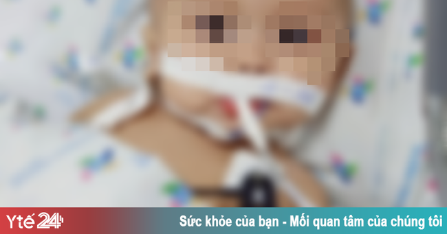 Cứu bé trai 1 tuổi mắc viêm màng não mủ nguy kịch - Ảnh 1.