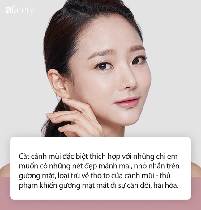 Chỉ cần cắt cánh mũi để giữ vẻ đẹp thon gọn, không cần nâng mũi: Liệu bạn có phải đối tượng phù hợp? - Ảnh 3.