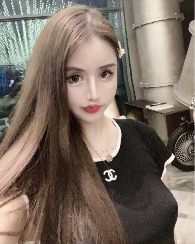 Mẫu nữ Trung Quốc nghiện dao kéo, gương mặt sau 101 lần phẫu thuật thẩm mỹ - Ảnh 3.