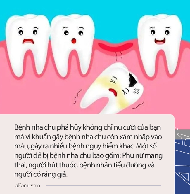 Người đàn ông 31 tuổi đi khám vì răng lung lay, nhưng bác sĩ lại nhổ tất cả răng vì sai lầm từ 2 năm trước của anh - Ảnh 3.