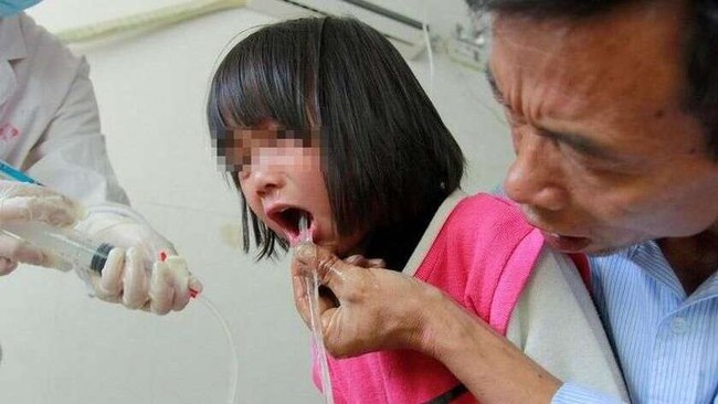 Bé gái 3 tuổi bị ngộ độc chì, bác sĩ: ba loại thực phẩm này cho trẻ ăn càng ít càng tốt - Ảnh 1. Bé gái 3 tuổi bị ngộ độc chì, bác sĩ: ba loại thực phẩm này cho trẻ ăn càng ít càng tốt - Ảnh 1.