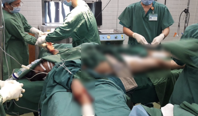 Người đàn ông bị cây cổ thụ đè trong mưa lớn ở TP.HCM chấn thương nặng, phải phẫu thuật gấp - Ảnh 2. Người đàn ông bị cây cổ thụ đè trong mưa lớn ở TP.HCM chấn thương nặng, phải phẫu thuật gấp - Ảnh 2.