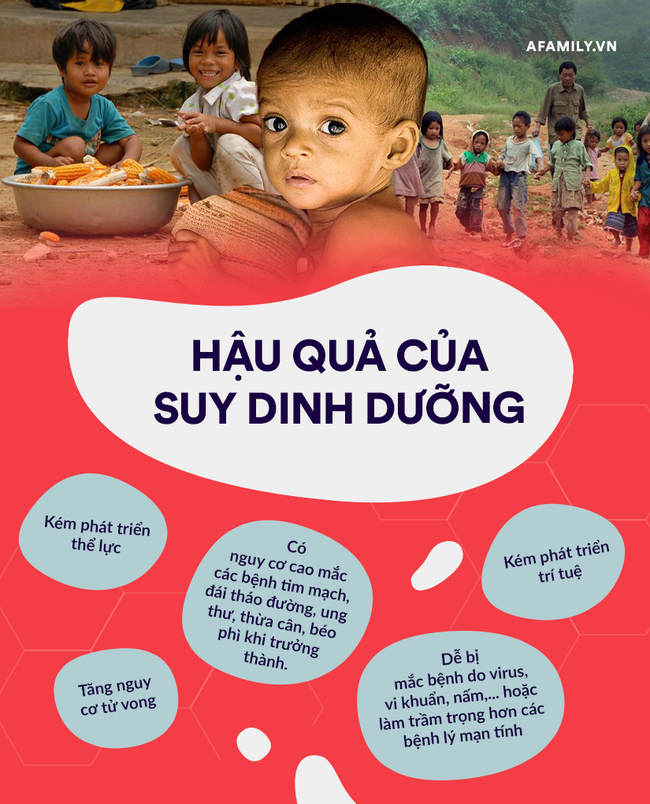 Giật mình trước những con số về thiếu vi chất dinh dưỡng ở trẻ em Việt Nam - Ảnh 5.