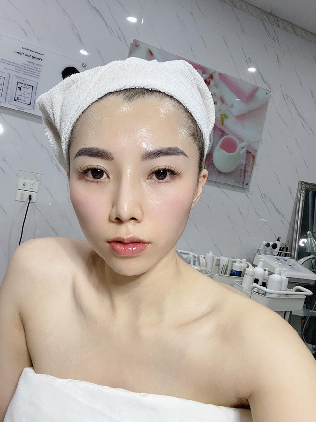 Phương pháp tiêm nghìn lỗ trên mặt: - Ảnh 4. Phương pháp tiêm nghìn lỗ trên mặt: - Ảnh 4.
