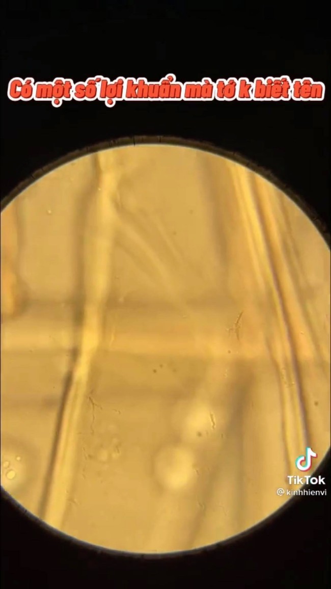 Xem clip soi trứng cá hồi sống dưới kính hiển vi, thứ hiện ra khiến ai nấy đều bất ngờ  - Ảnh 6.