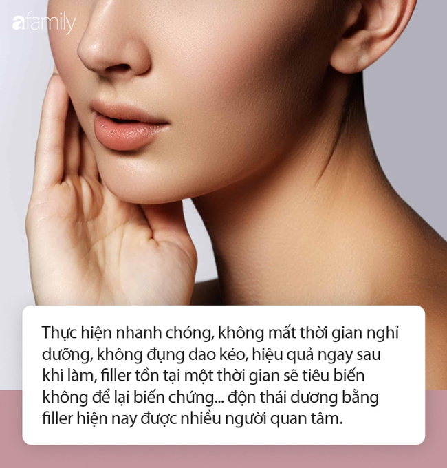 Độn thái dương bằng filler để tăng vẻ đẹp phú quý lên ngôi dịp Tết: Trước khi làm cần lưu ý 3 điều quan trọng! - Ảnh 2.