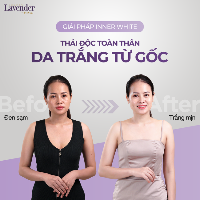 5 dịch vụ spa làm đẹp cấp tốc trước Tết, chị em ghim ngay để tranh thủ "tút tát" cho kịp - Ảnh 11. 5 dịch vụ spa làm đẹp cấp tốc trước Tết, chị em ghim ngay để tranh thủ "tút tát" cho kịp - Ảnh 11.