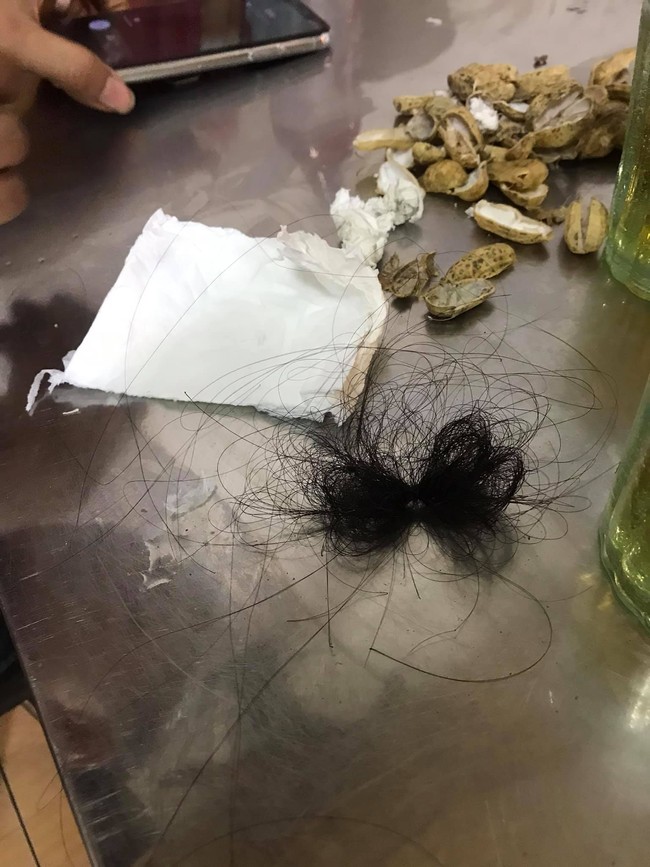 Đi bar rồi bị người yêu quản lý túm tóc, ném gạt tàn, khách phẫn nộ nhất bởi thái độ "xin lỗi đấy được chưa" của kẻ gây sự - Ảnh 3. đi bar bị hành hung