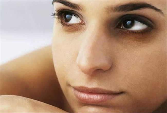 Phụ nữ đừng bỏ qua quầng thâm mắt, rất có thể là do 5 vấn đề sức khỏe dưới đây - Ảnh 4.