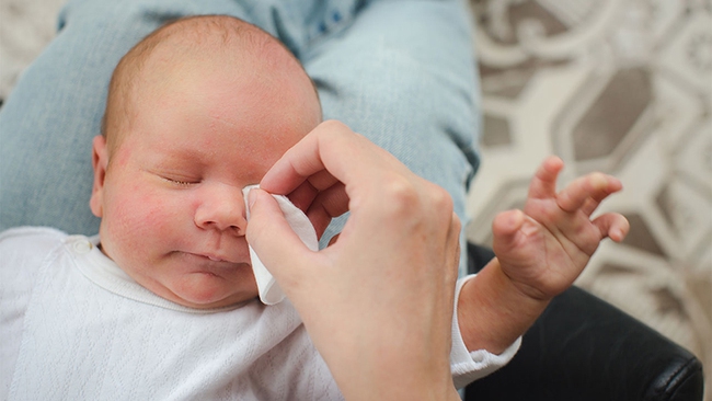 How to care for babies' eyes?  Measures to prevent eye diseases for children - Photo 3.