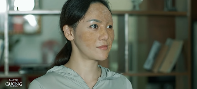 Mặt nạ gương tập 6 khiến khán giả rùng mình với khuôn mặt bị bỏng biến dạng của nữ bệnh nhân - Ảnh 4.