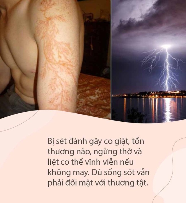 Kỳ lạ người đàn ông bị sét đánh 7 lần liên tục, cơ thể tổn thương từ bên ngoài đến nội tạng vẫn không chết, được người ta mệnh danh là &quot;vua lỳ đòn&quot; - Ảnh 6.