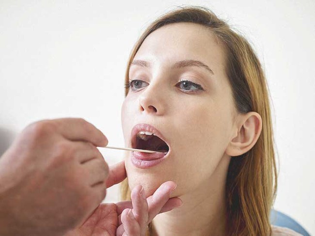 Nguyên nhân phổ biến khiến lưỡi chuyển sang màu trắng và cách ngăn ngừa tình trạng này - Ảnh 4.
