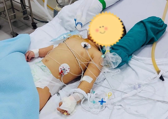 Té ngã vào xô nước, bé trai 14 tháng tuổi nguy kịch, BS cảnh báo sai lầm cần tránh khi sơ cứu bệnh nhân đuối nước - Ảnh 1.