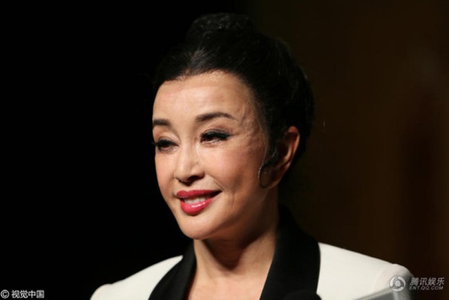 Mỹ nhân Hoa ngữ nhận kết đắng vì đam mê "dao kéo" - Ảnh 14. Mỹ nhân Hoa ngữ nhận kết đắng vì đam mê "dao kéo" - Ảnh 14.