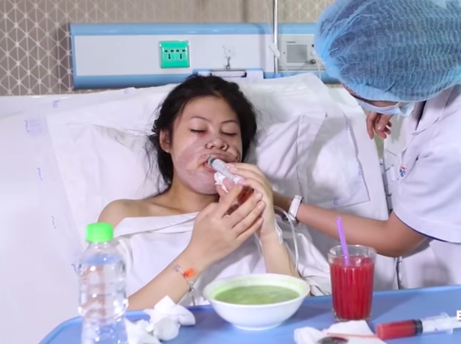 Đầu năm chiêm ngưỡng màn lột xác "khủng" của cô gái có ngoại hình Thị Nở, hiện tại xinh đẹp như hotgirl nhưng vẫn ám ảnh ký ức "đêm phẫu thuật định mệnh" - Ảnh 3. Đầu năm chiêm ngưỡng màn lột xác "khủng" của cô gái có ngoại hình Thị Nở, hiện tại xinh đẹp như hotgirl nhưng vẫn ám ảnh ký ức "đêm phẫu thuật định mệnh" - Ảnh 3.