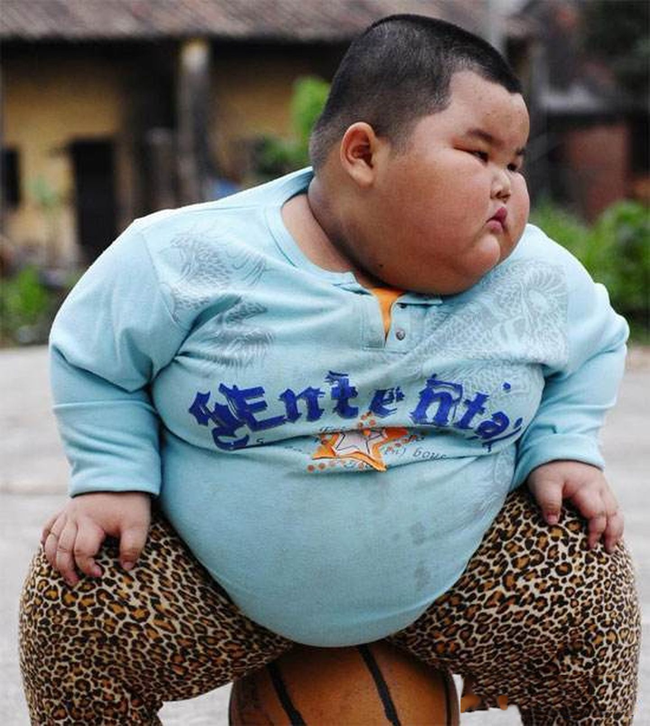 Bé trai 5 tuổi đã nặng 60kg, bị gan nhiễm mỡ nặng, sau khi thăm khám bác sĩ ngán ngẩm vì cách cho ăn của cha mẹ - Ảnh 1.