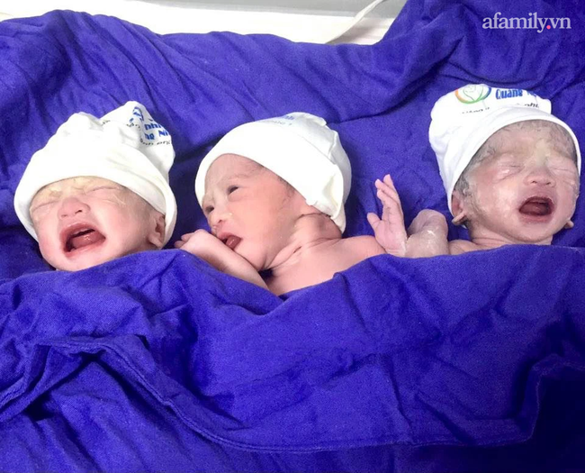 Bệnh viện Sản Nhi Quảng Ninh:Mổ thành công ca sinh 3, hai bé gái một bé trai - Ảnh 3.