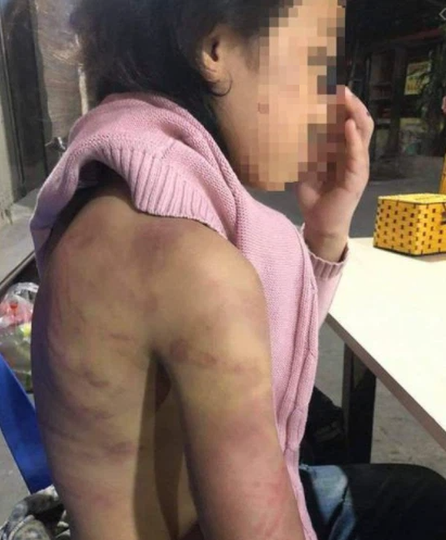 Vụ bé gái 12 tuổi nghi bị mẹ đẻ bạo hành, người tình của mẹ xâm hại: Mẹ và người tình có thể đối mặt với hình phạt gì? - Ảnh 4. Vụ bé gái 12 tuổi nghi bị mẹ đẻ bạo hành, người tình của mẹ xâm hại: Mẹ và người tình có thể đối mặt với hình phạt gì? - Ảnh 4.