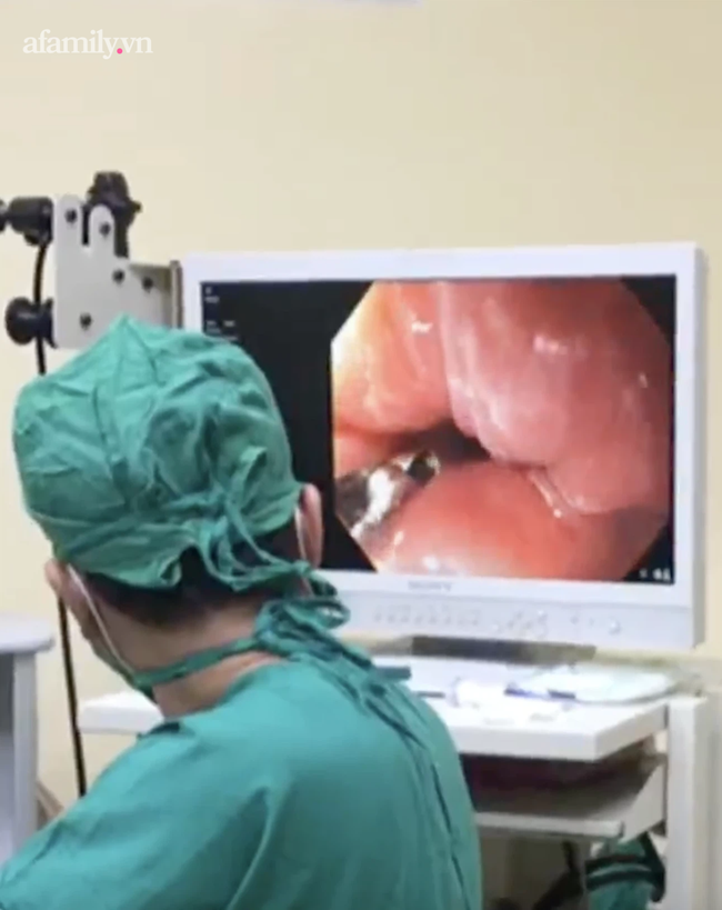 Bé trai 24 tháng tuổi nuốt ngẹn hạt xí muội, suýt chết vì tắt đường thở ngay ngày đầu năm mới - Ảnh 1. Bé trai 24 tháng tuổi nuốt ngẹn hạt xí muội, suýt chết vì tắt đường thở ngay ngày đầu năm mới - Ảnh 1.