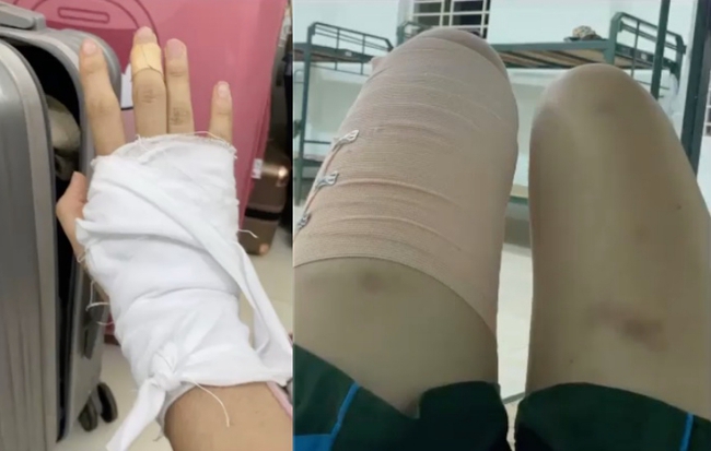 Sao nhập ngũ: Khánh Vân gây sốc với đôi chân đầy vết thương bầm tím, bật khóc vì làm nhiệm vụ quá khổ - Ảnh 3.