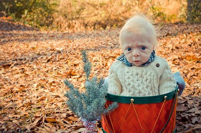 Chùm ảnh: Những em bé sơ sinh có khuôn mặt “già như trái cà” khiến cha mẹ được một phen “hết hồn” nhưng lại gây bão mạng thế giới - Ảnh 10.