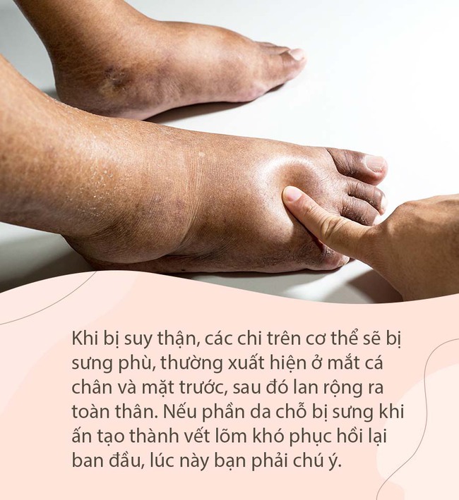 Sau đêm tân hôn, chàng trai bị vợ đòi ly hôn chỉ vì giấu nhẹm căn bệnh này của mình - Ảnh 1.