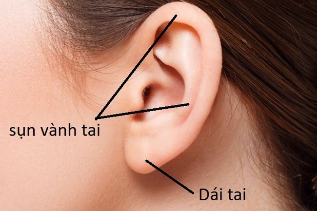 Biến chứng nâng mũi bằng sụn tai: Ai muốn làm cũng nên lưu ý - Ảnh 1.