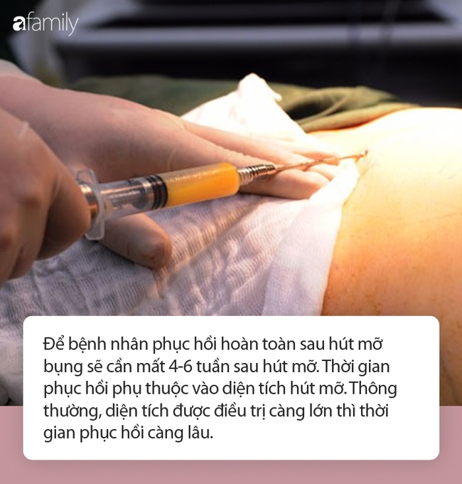 Hút mỡ bụng: Sau phẫu thuật bao lâu có thể đi lại, sinh hoạt bình thường? - Ảnh 4. Hút mỡ bụng: Sau phẫu thuật bao lâu có thể đi lại, sinh hoạt bình thường? - Ảnh 4.