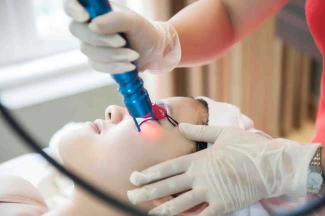 Trị nám bằng laser kiêng ăn gì? - Ảnh 2.