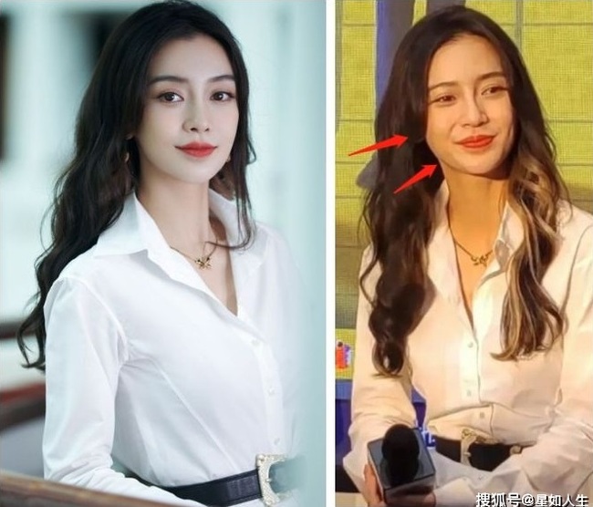 Gương mặt của Angelababy ngày càng khác lạ khiến netizen không thể nhận ra.