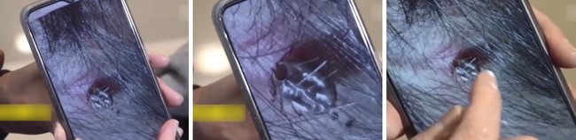 Con trai nói ngứa đầu, gia đình phát hiện sau gáy bé có "cục thịt dư", 3 hành động dứt khoát của người mẹ được bác sĩ khen ngợi - Ảnh 2. Con trai nói ngứa đầu, gia đình phát hiện sau gáy bé có "cục thịt dư", 3 hành động dứt khoát của người mẹ được bác sĩ khen ngợi - Ảnh 2.