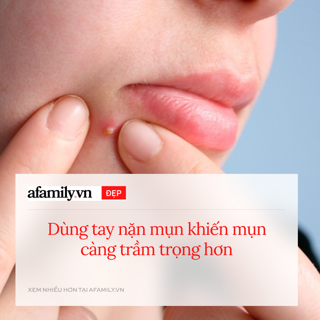 Cảnh báo: 8 bước skincare càng làm càng khiến da xấu tệ hại - Ảnh 5. Cảnh báo: 8 bước skincare càng làm càng khiến da xấu tệ hại - Ảnh 5.