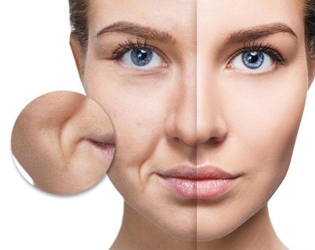 Có một "bí mật bệnh tật" ẩn trong nếp nhăn, ai cũng cần biết để phòng tránh - Ảnh 4. Có một "bí mật bệnh tật" ẩn trong nếp nhăn, ai cũng cần biết để phòng tránh - Ảnh 4.