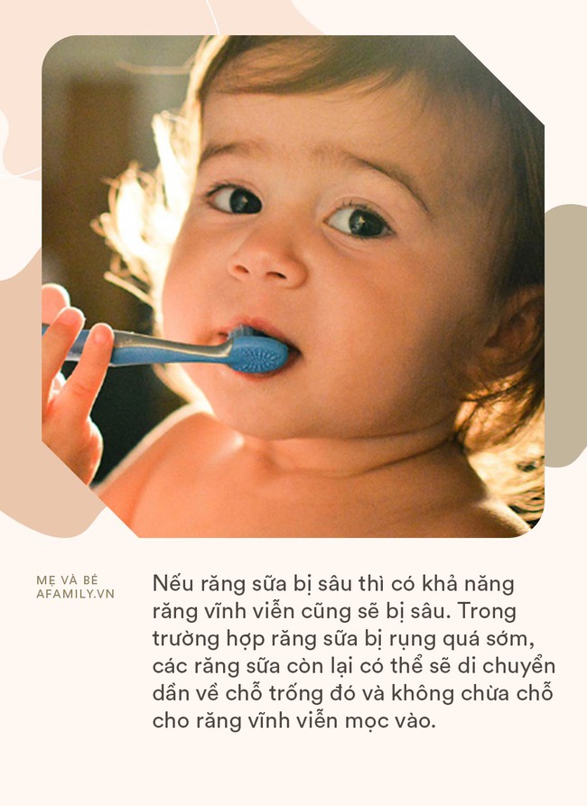 Không ăn bánh kẹo và đánh răng đều đặn 2 lần/ngày, bé trai 3 tuổi vẫn bị sâu cả hàm răng chỉ vì lỗi của mẹ - Ảnh 2.