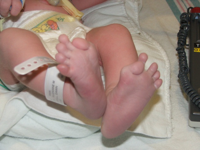 Thấy con gái mới sinh có ngón chân cái kỳ lạ, bố mẹ đi xét nghiệm gen rồi &quot;hóa đá&quot; khi nghe kết quả - Ảnh 5.