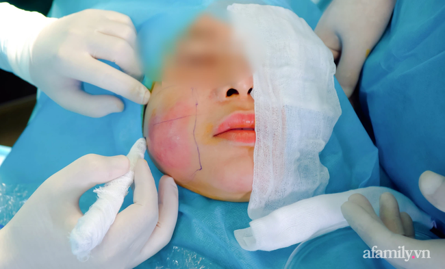 Cô gái tiêm filler bị hoại tử mặt nặng cầu cứu bệnh viện thẩm mỹ giữa lúc đang giãn cách vì dịch COVID-19 - Ảnh 4.