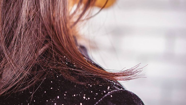 Dành cho mái tóc gãy rụng nhiều: Công thức ủ tóc tự nhiên khi nhà bạn "cạn kiệt" sản phẩm hấp tóc - Ảnh 16. tóc gãy rụng nhiều, tóc hư tổn, công thức ủ tóc, chăm sóc tóc tại nhà, dưỡng tóc, tóc khô xơ, tóc dầu