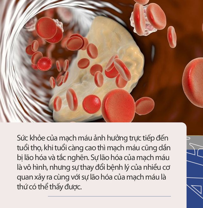 Cụ bà 103 tuổi có mạch máu khỏe mạnh như người mới 60 tuổi, bí quyết trường thọ không phải là đi bộ mà chính ở 3 điều - Ảnh 3.