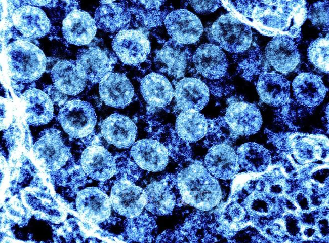 WHO theo dõi biến thể mới có khả năng kháng vaccine - Ảnh 1. WHO theo dõi biến thể mới có khả năng kháng vaccine - Ảnh 1.