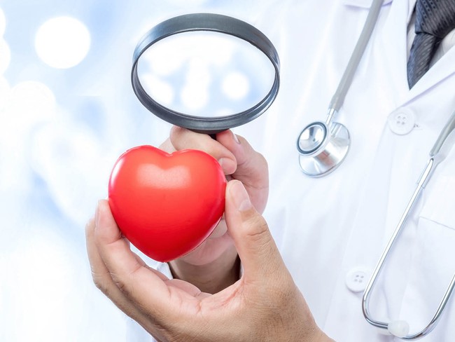 Những câu hỏi thường gặp về sức khỏe tim mạch và lời giải đáp đến từ chuyên gia - Ảnh 4.