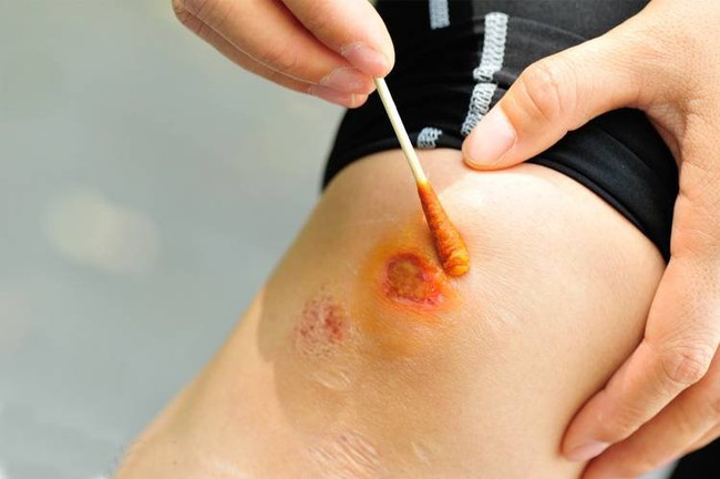 Xuất hiện trào lưu dùng Betadine làm thuốc xịt mũi, nước súc miệng để ngăn chặn Covid-19: Chuyên gia lên tiếng cảnh báo! - Ảnh 3. Xuất hiện trào lưu dùng Betadine làm thuốc xịt mũi, nước súc miệng để ngăn chặn Covid-19: Chuyên gia lên tiếng cảnh báo! - Ảnh 3.